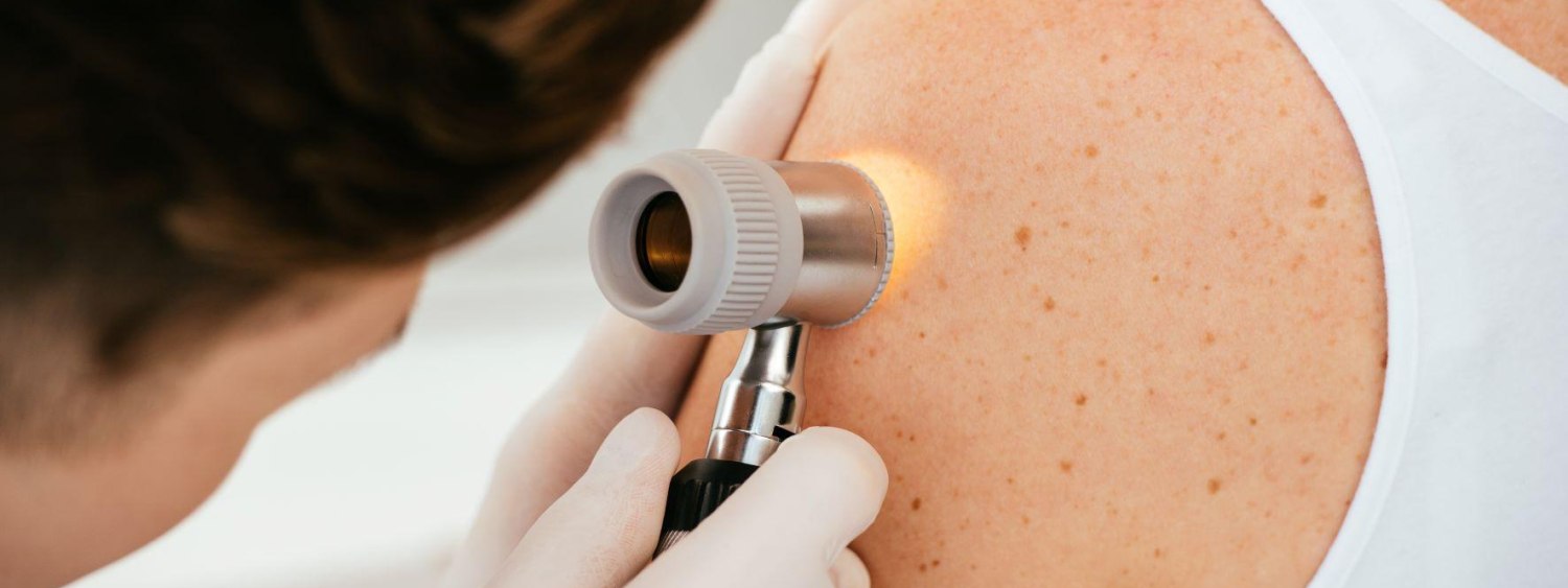 Hobart skin cancer clinic home