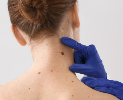 Hobart Skin Cancer Clinic is dedicated to providing proactive & high-quality care in the detection, treatment and prevention of skin cancers.